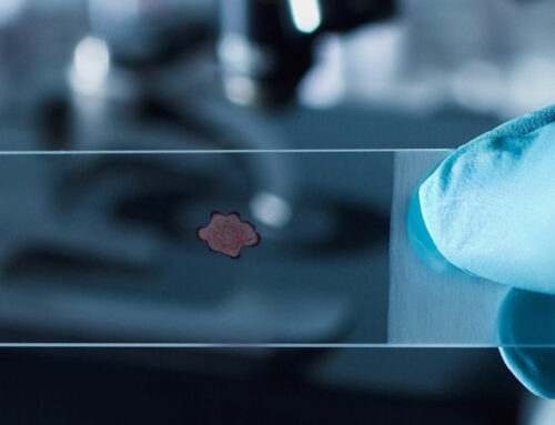 Point of Care Diagnostics Device Verification